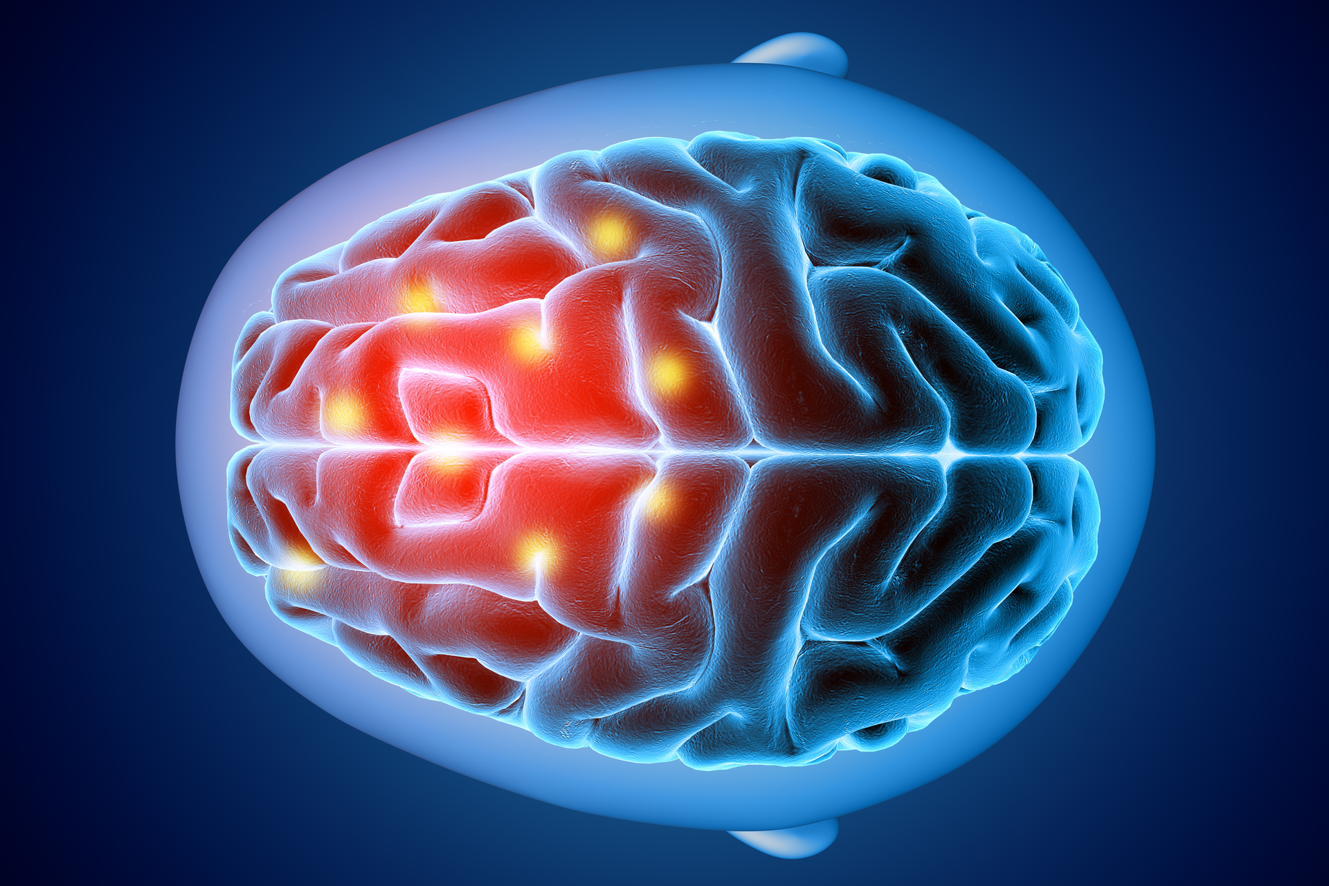 Estimulação cerebral contra a depressão